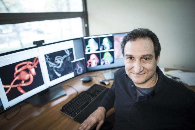 Mason researchers study risk factors of brain aneurysms and effective treatments for high-risk patients