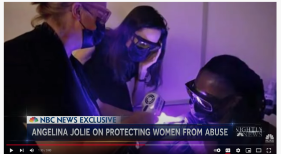 Angelina Jolie discusses alternate light sources for bruise detection with Mason’s Katherine Scafide