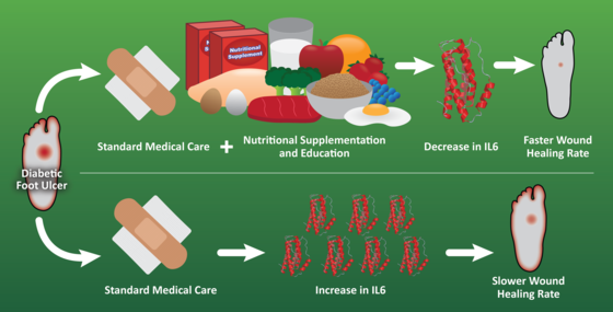 Nutritional supplements and education decrease inflammation in diabetic patients with foot ulcers